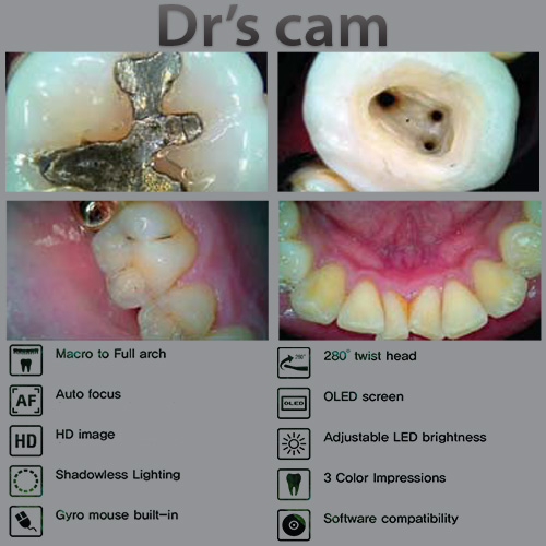 دوربین داخل دهانی بی سیم Dr’s Cam - 2