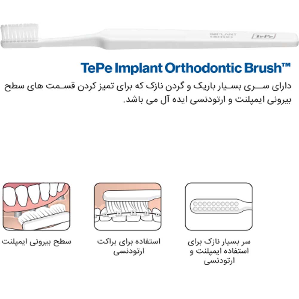 مسواک ویژه ارتودنسی و ایمپلنت - 2
