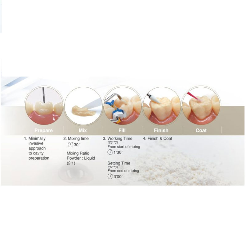 گلاس آینومر ترمیمی زیرکونومو پی- شوفو - 2