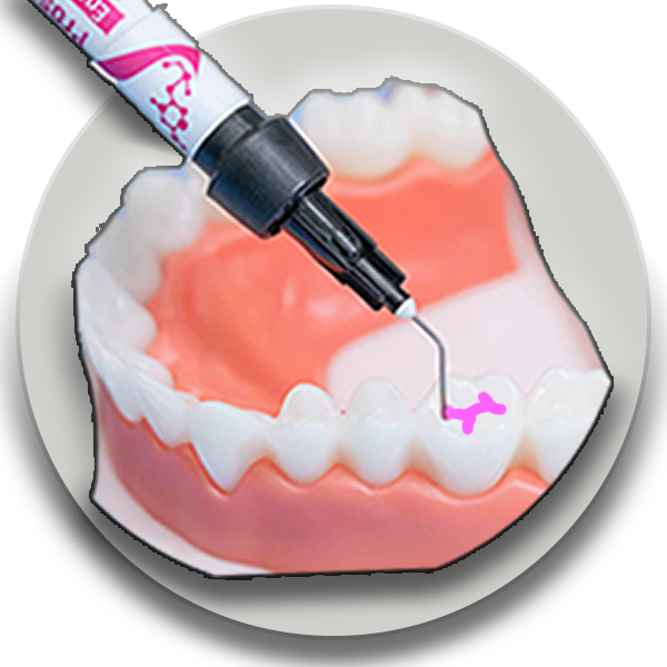 فیشورسیلانت-پانسمان