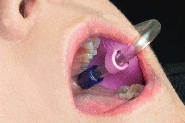 نگهدارنده سرساکشن آمریکایی